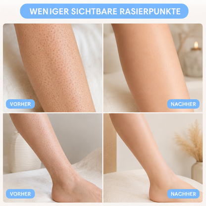 SilkErase – Glatte Haut ohne rote Punkte, Stoppeln und Brennen